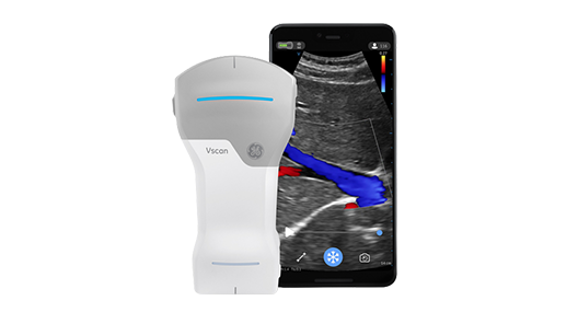 Images of GE-made small echo Vscan