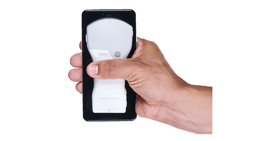 Images of GE-made small echo Vscan